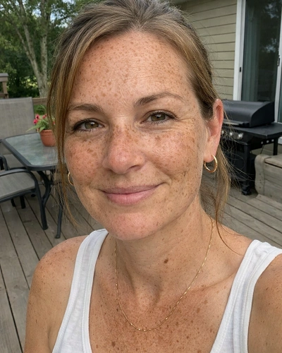 Freckles and Sunspots